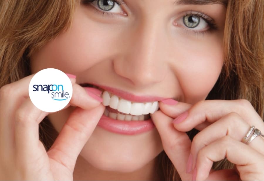 Carillas Postiza Dentadura SnapOn Smile